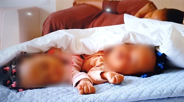 Marie et Grâce, deux bébés siamois de six mois, ont été séparées avec succès à l'Hôpital Mère-Enfant de Bingerville, Côte d'Ivoire © Crédit photo DR Marie et Grâce, deux bébés siamois de six mois, ont été séparées avec succès à l'Hôpital Mère-Enfant de Bingerville, Côte d'Ivoire © Crédit photo DR